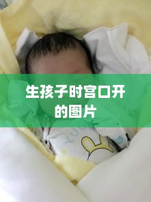 生孩子时宫口开的图片
